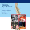 The ASSI Monographs: Lumbar Disc Herniation PDF
