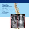 The ASSI Monographs: Early Onset Scoliosis PDF