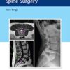 Instrumentation for Minimally Invasive Spine Surgery 1st Edition