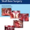 Atlas of 360 degrees Skull Base Surgery PDF