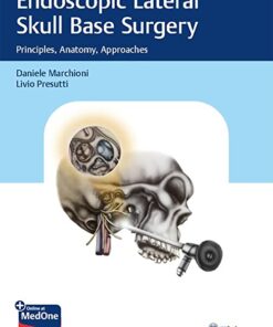 Video Endoscopic Lateral Skull Base Surgery: Principles, Anatomy, Approaches 1st Edition