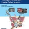 Video Essential Step-by-step Techniques for Minimally Invasive Spinal Surgery 1st Edition