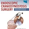 Endoscopic Craniosynostosis Surgery PDF