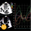 Echocardiography – A Comprehensive Review 2022 (CME VIDEOS)