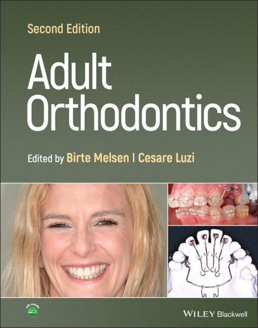 Adult Orthodontics 2nd Edition PDF