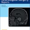 ​Journal of Neurological Surgery Reports Volume : 83 2022 PDF