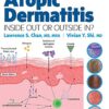 Atopic Dermatitis: Inside Out or Outside In 1st Edition PDF Original
