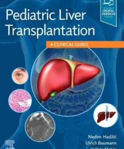 Pediatric Liver Transplantation: A Clinical Guide 1st Edition PDF Original