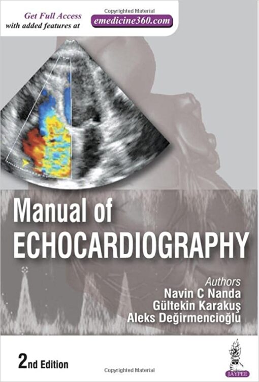 Manual of Echocardiography, 2nd Edition (Original PDF from Publisher)