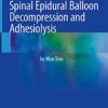 Spinal Epidural Balloon Decompression and Adhesiolysis 1st ed. 2021 Edition PDF Original