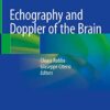 Echography and Doppler of the Brain 1st ed. 2021 Edition PDF Original