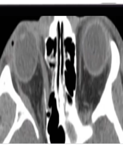 Imaging Victims of Violence Fists, Stabs, Bullets, and Blasts 2021 (CME VIDEOS)