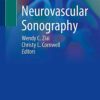 Neurovascular Sonography 1st ed. 2022 Edition PDF Original