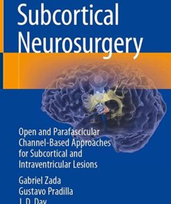 Subcortical Neurosurgery: Open and Parafascicular Channel-Based Approaches for Subcortical and Intraventricular Lesions 1st ed. 2022 Edition PDF Original