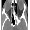 ARRS Imaging Victims of Violence: Fists, Stabs, Bullets, and Blasts 2021 (CME VIDEOS)