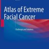 Atlas of Extreme Facial Cancer: Challenges and Solutions 1st ed. 2022 Edition PDF Original
