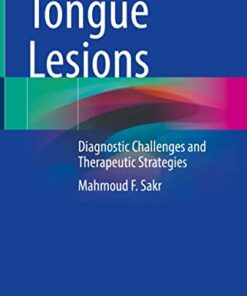 Tongue Lesions: Diagnostic Challenges and Therapeutic Strategies 1st ed. 2022 Edition PDF Original