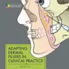 Adapting Dermal Fillers in Clinical Practice (Original PDF from Publisher)
