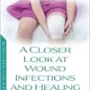 A Closer Look at Wound Infections and Healing (New Developments in Medical Research) (Original PDF from Publisher)
