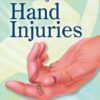 Acute Management of Hand Injuries (Original PDF from Publisher)