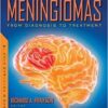 Meningiomas: From Diagnosis to Treatment (Original PDF From Publisher)