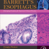 Barrett's Esophagus Emerging Evidence for Improved Clinical Practice