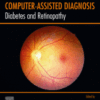Diabetes and Retinopathy Volume 2: Computer-Assisted Diagnosis A volume in Computer-Assisted Diagnosis