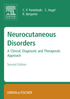 Neurocutaneous Disorders A Clinical, Diagnostic and Therapeutic Approach