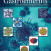 Viral Gastroenteritis Molecular Epidemiology and Pathogenesis