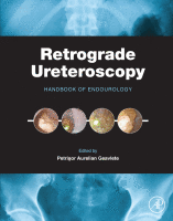 Retrograde Ureteroscopy Handbook of Endourology