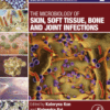 The Microbiology of Skin, Soft Tissue, Bone and Joint Infections Volume 2 in Clinical Microbiology: Diagnosis, Treatments and Prophylaxis of Infections