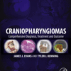 Craniopharyngiomas Comprehensive Diagnosis, Treatment and Outcome