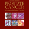 Prostate Cancer Science and Clinical Practice