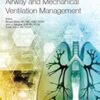 Airway and Mechanical Ventilation Management
