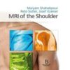 MRI of the Shoulder