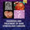 Offering a one-stop guide to recognition and therapeutic decision making, Diagnosis and Treatment of Rare Gynecologic Cancers fills a gap in the medical literature on uncommon ovarian, uterine, cervical, and vulvovaginal cancers and trophoblastic diseases