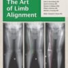 The Art of Limb Alignment, Tenth Edition