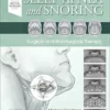 Sleep Apnea and Snoring: Surgical and Non-Surgical Therapy, 2nd edition (Videos Only, Well Organized)