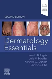 Dermatology Essentials, 2nd Edition