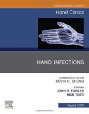 Hand Infections, An Issue of Hand Clinics (Volume 36-3) (The Clinics: Orthopedics, Volume 36-3) (Original PDF