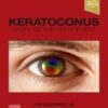 Keratoconus: Diagnosis and Management (Original PDF