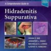 A Comprehensive Guide to Hidradenitis Suppurativa