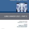 Lung Cancer 2021, Part 2, An Issue of Thoracic Surgery Clinics (Volume 31-4) (The Clinics: Surgery, Volume 31-4) 20221 Original PDF