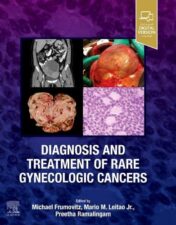 Diagnosis and Treatment of Rare Gynecologic Cancers 2022 Original PDF