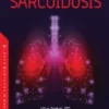 A Clinical Manual of Sarcoidosis