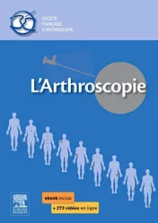 L'arthroscopie (Hors collection) (French Edition)