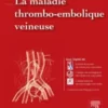 La maladie thrombo-embolique veineuse (Hors collection) (French Edition) (Original PDF
