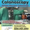 Dr. Carl’s Colonoscopy insertion method: Painless Non-loop Colonoscopy 2021 AZW 3 + EPUB + Converted PDF)