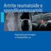 Artrite reumatoide e spondiloentesoartriti: Diagnostica Per Immagini Ed Imaging Follow-Up