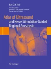 Atlas of Ultrasound- and Nerve Stimulation-Guided Regional Anesthesia (Original PDF
